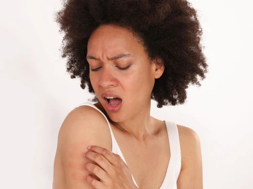 Image of a woman's arm with a visible rash, displaying skin inflammation.