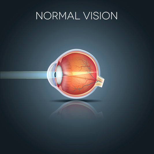 Detailed illustration of optic nerve structure with labeled components.